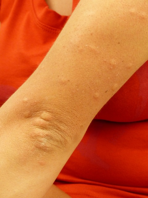 Tips for Coping with Allergies